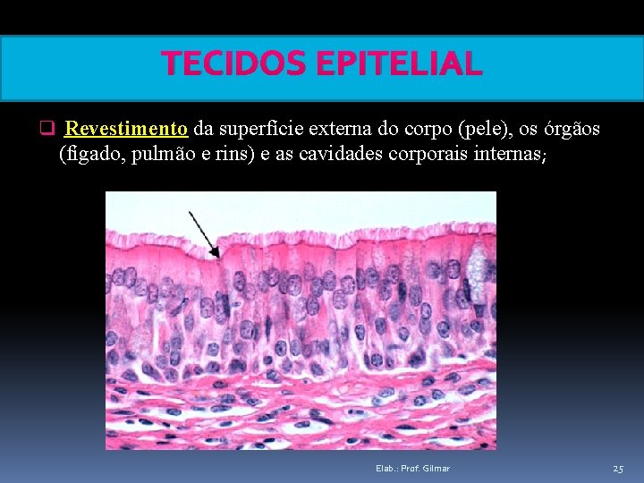 TECIDOS EPITELIAL q Revestimento da superfície externa do corpo (pele), os órgãos (fígado, pulmão