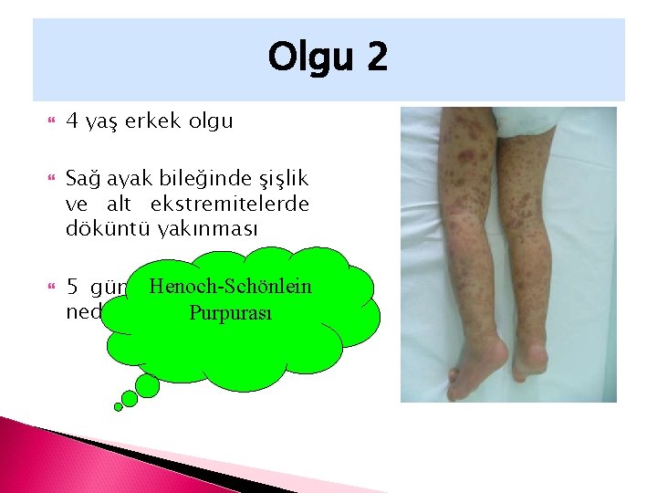 Olgu 2 4 yaş erkek olgu Sağ ayak bileğinde şişlik ve alt ekstremitelerde döküntü
