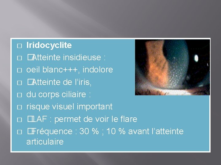 � � � � Iridocyclite � Atteinte insidieuse : oeil blanc+++, indolore � Atteinte