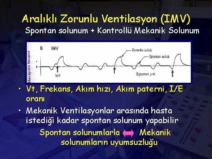 Aralıklı Zorunlu Ventilasyon (IMV) Spontan solunum + Kontrollü Mekanik Solunum • Vt, Frekans, Akım