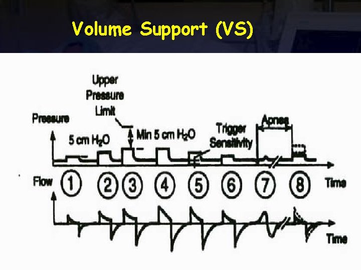 Volume Support (VS) 