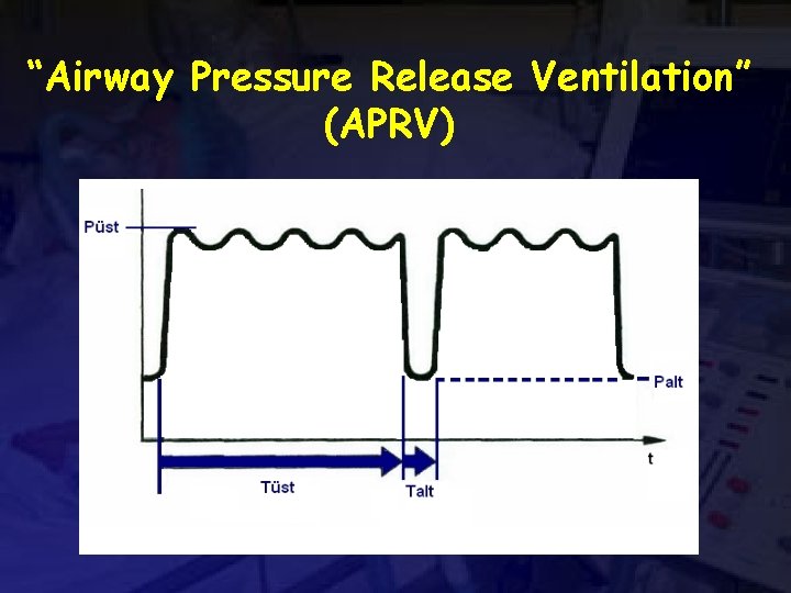 “Airway Pressure Release Ventilation” (APRV) 