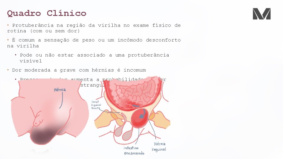 Quadro Clínico • Protuberância na região da virilha no exame físico de rotina (com Quadro Clínico • Protuberância na região da virilha no exame físico de rotina (com