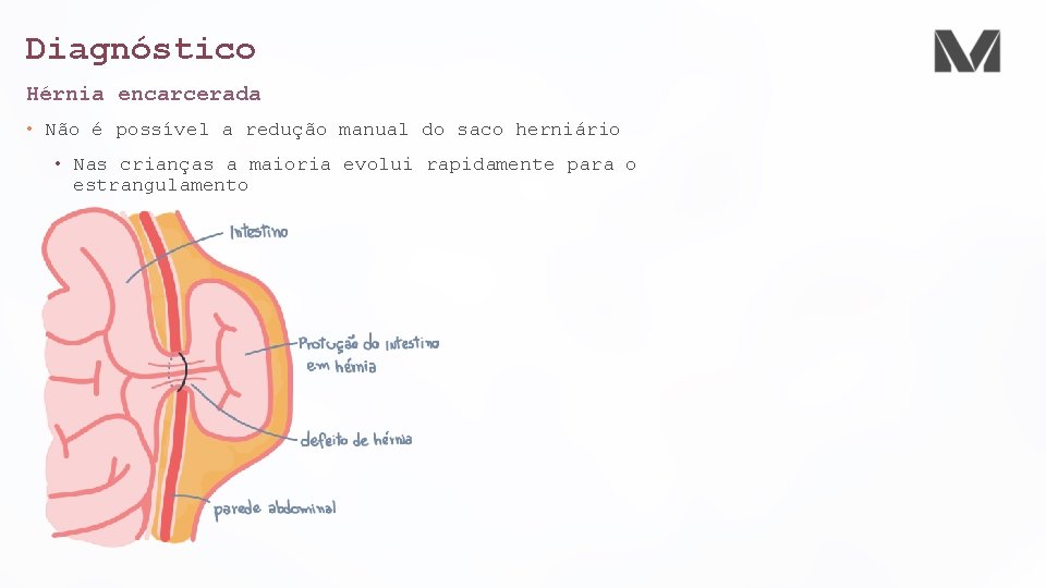 Diagnóstico Hérnia encarcerada • Não é possível a redução manual do saco herniário • Diagnóstico Hérnia encarcerada • Não é possível a redução manual do saco herniário •