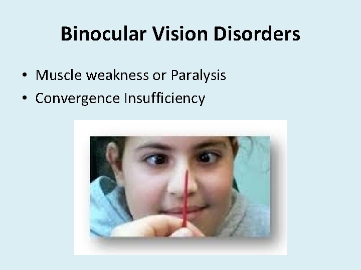 Binocular Vision Disorders • Muscle weakness or Paralysis • Convergence Insufficiency 