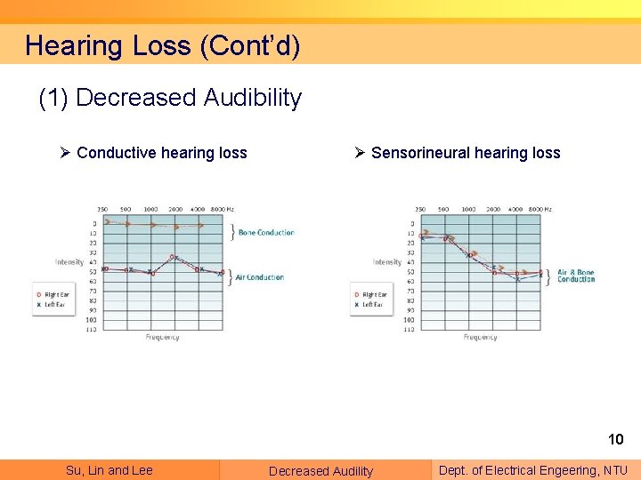 Hearing Loss (Cont’d) (1) Decreased Audibility Ø Conductive hearing loss Ø Sensorineural hearing loss