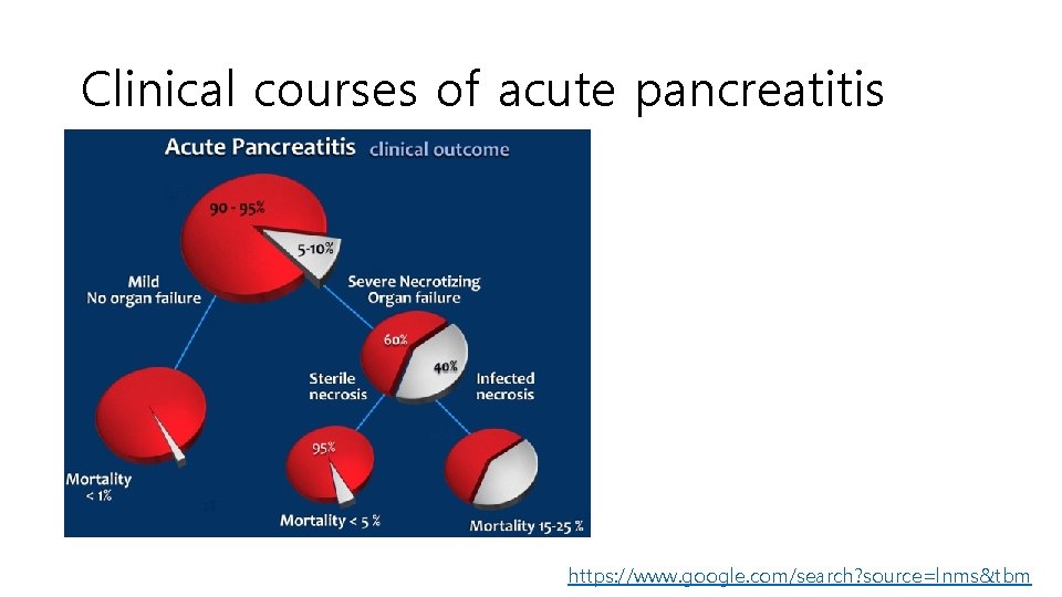 Clinical courses of acute pancreatitis https: //www. google. com/search? source=lnms&tbm 