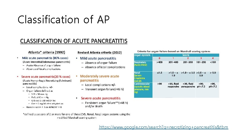 Classification of AP https: //www. google. com/search? q=necrotizing+pancreatitis&tbm 