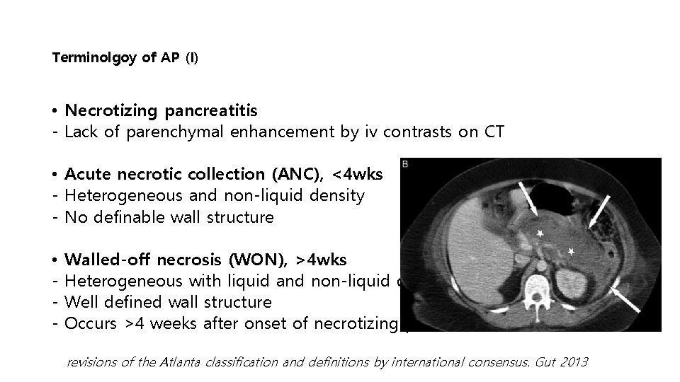 Terminolgoy of AP (I) • Necrotizing pancreatitis - Lack of parenchymal enhancement by iv