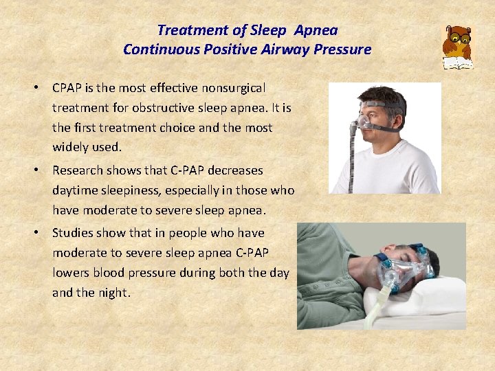 Treatment of Sleep Apnea Continuous Positive Airway Pressure • CPAP is the most effective