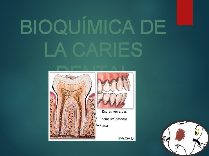 BIOQUÍMICA DE LA CARIES DENTAL 