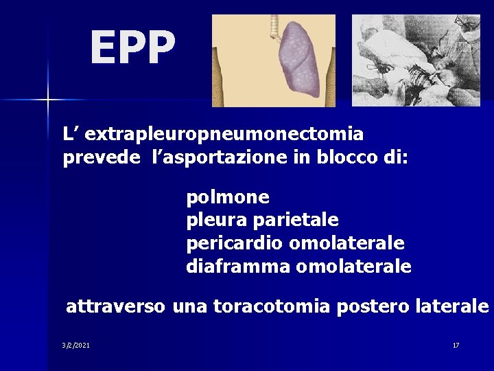 EPP L’ extrapleuropneumonectomia prevede l’asportazione in blocco di: polmone pleura parietale pericardio omolaterale diaframma