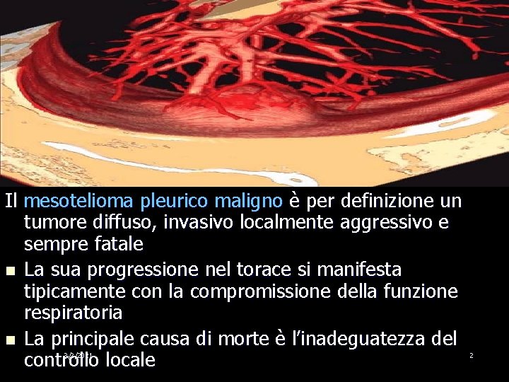 Il mesotelioma pleurico maligno è per definizione un tumore diffuso, invasivo localmente aggressivo e