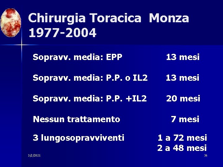 Chirurgia Toracica Monza 1977 -2004 Sopravv. media: EPP 13 mesi Sopravv. media: P. P.