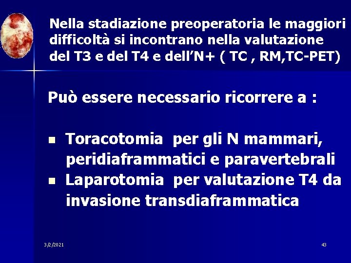 Nella stadiazione preoperatoria le maggiori difficoltà si incontrano nella valutazione del T 3 e