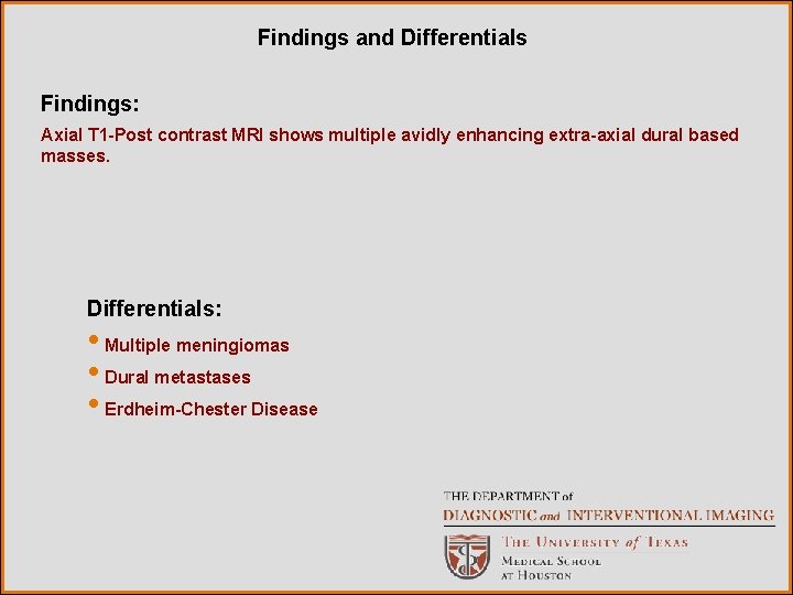 Findings and Differentials Findings: Axial T 1 -Post contrast MRI shows multiple avidly enhancing