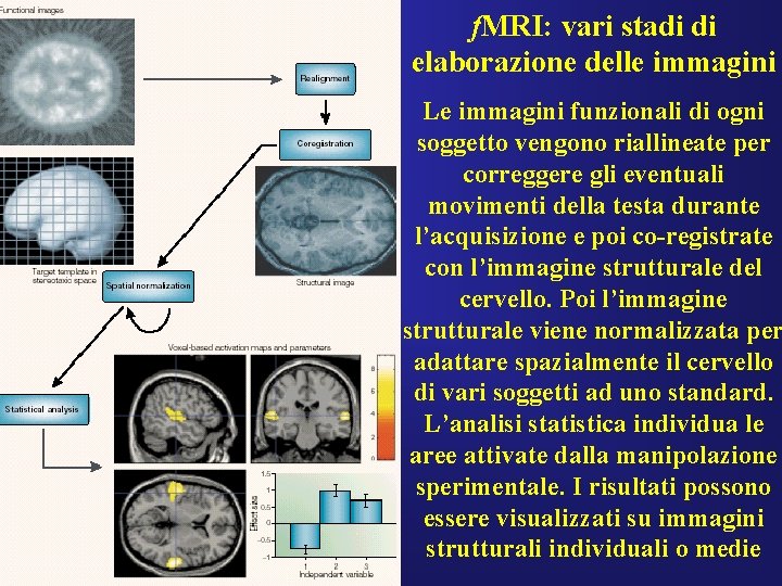 f. MRI: vari stadi di elaborazione delle immagini Le immagini funzionali di ogni soggetto