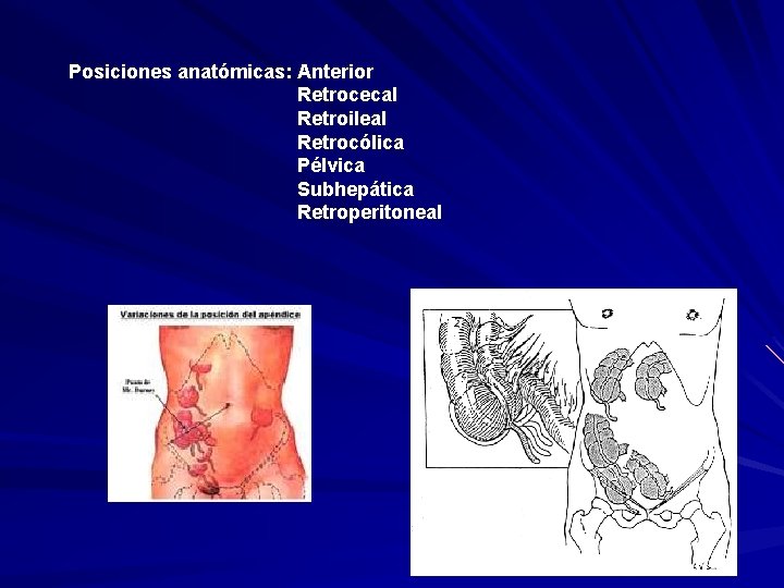 Posiciones anatómicas: Anterior Retrocecal Retroileal Retrocólica Pélvica Subhepática Retroperitoneal 