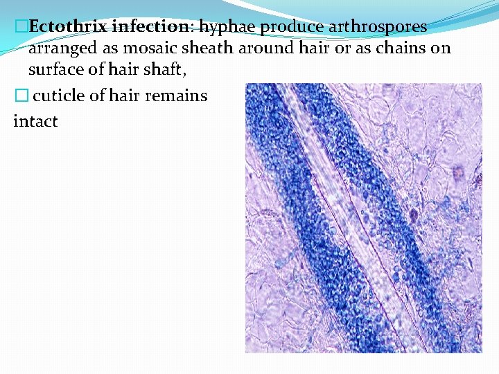 �Ectothrix infection: hyphae produce arthrospores arranged as mosaic sheath around hair or as chains