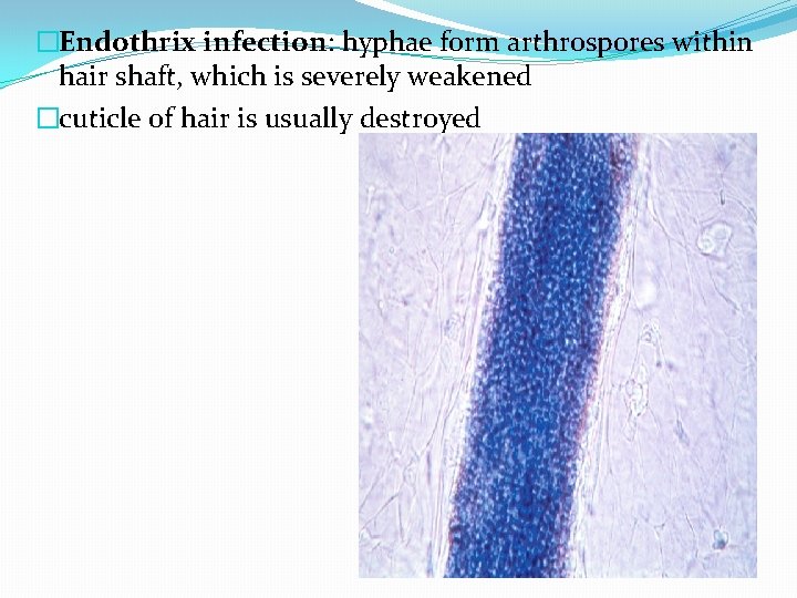 �Endothrix infection: hyphae form arthrospores within hair shaft, which is severely weakened �cuticle of
