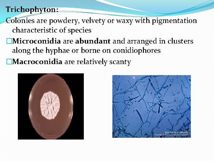 Trichophyton: Colonies are powdery, velvety or waxy with pigmentation characteristic of species �Microconidia are