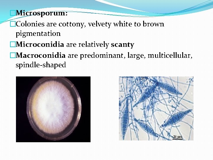�Microsporum: �Colonies are cottony, velvety white to brown pigmentation �Microconidia are relatively scanty �Macroconidia