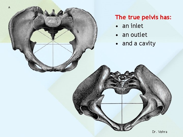 The true pelvis has: • an inlet • an outlet • and a cavity