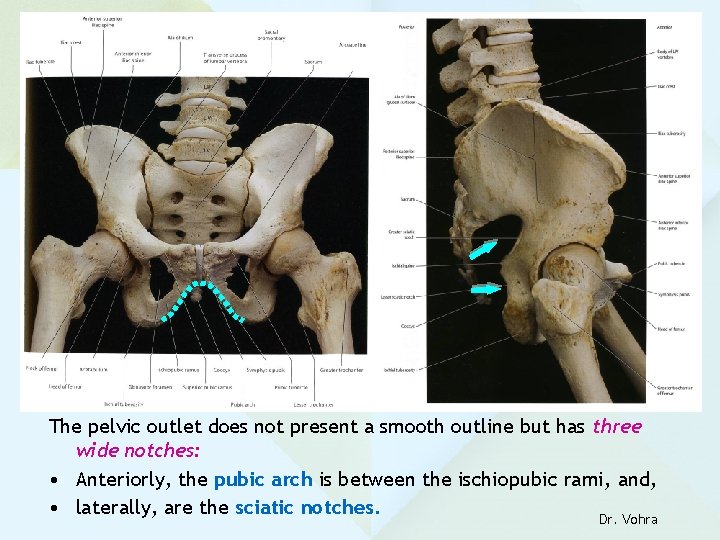 The pelvic outlet does not present a smooth outline but has three wide notches:
