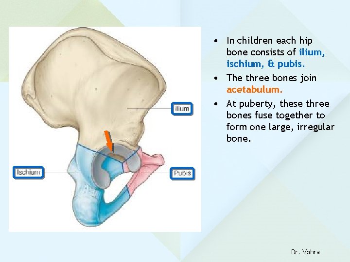  • In children each hip bone consists of ilium, ischium, & pubis. •