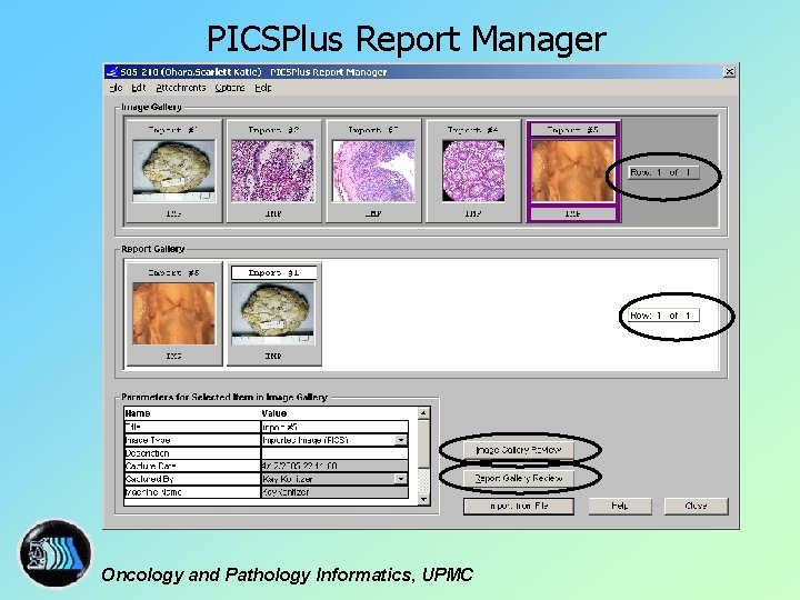 PICSPlus Report Manager Oncology and Pathology Informatics, UPMC 