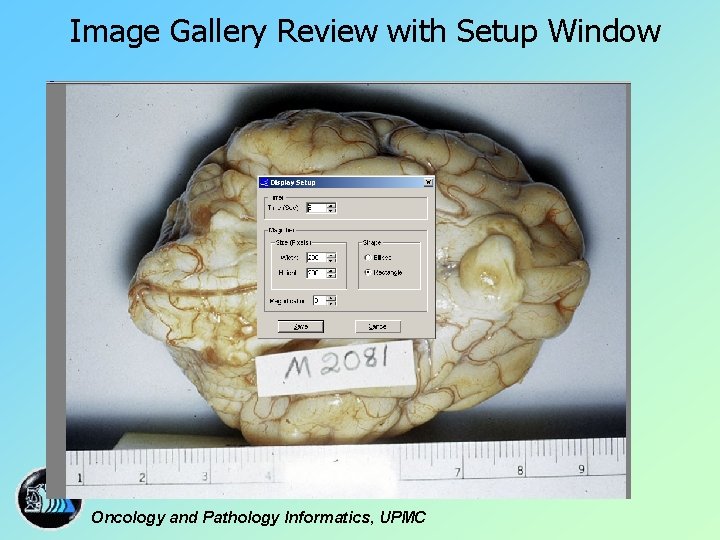 Image Gallery Review with Setup Window Oncology and Pathology Informatics, UPMC 