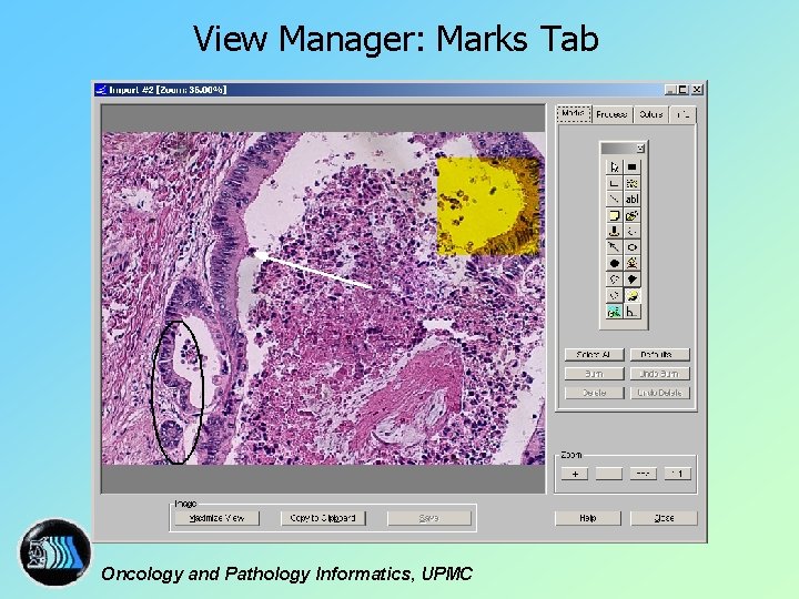 View Manager: Marks Tab Oncology and Pathology Informatics, UPMC 