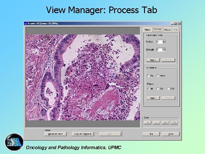 View Manager: Process Tab Oncology and Pathology Informatics, UPMC 