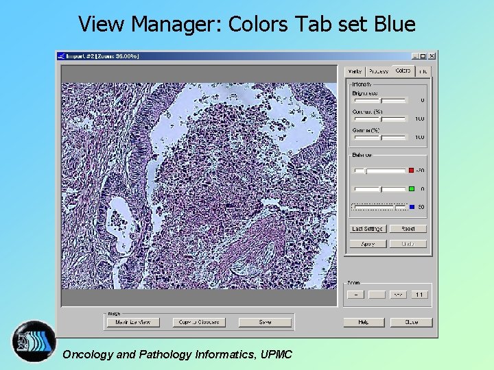 View Manager: Colors Tab set Blue Oncology and Pathology Informatics, UPMC 