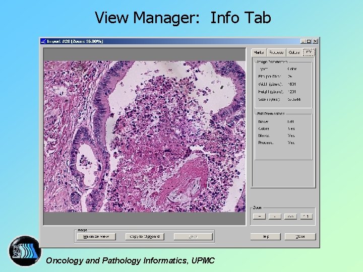 View Manager: Info Tab Oncology and Pathology Informatics, UPMC 