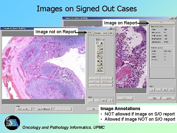 Images on Signed Out Cases Image on Report Image not on Report Image Annotations