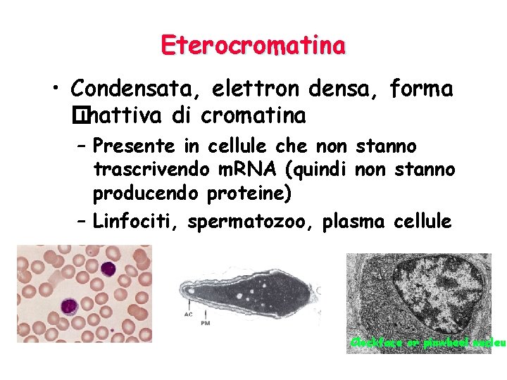 Eterocromatina • Condensata, elettron densa, forma � inattiva di cromatina – Presente in cellule