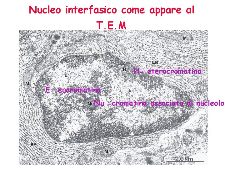 Nucleo interfasico come appare al T. E. M H= eterocromatina E= eucromatina Nu =cromatina