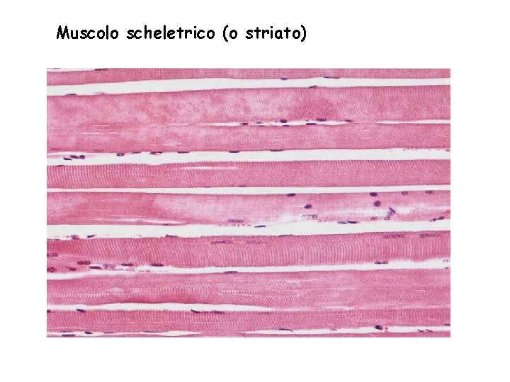 Muscolo scheletrico (o striato) 