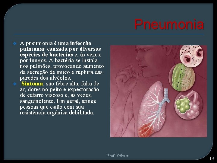 Pneumonia v v A pneumonia é uma infecção pulmonar causada por diversas espécies de