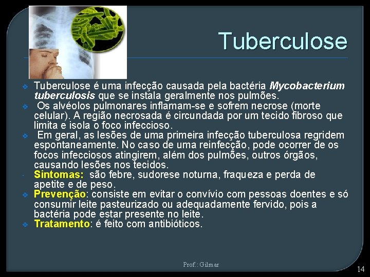 Tuberculose v v v Tuberculose é uma infecção causada pela bactéria Mycobacterium tuberculosis que