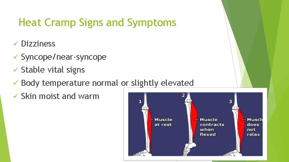 Heat Cramp Signs and Symptoms ü Dizziness ü Syncope/near-syncope ü Stable vital signs ü