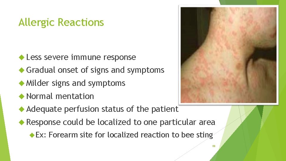 Allergic Reactions Less severe immune response Gradual Milder onset of signs and symptoms Normal
