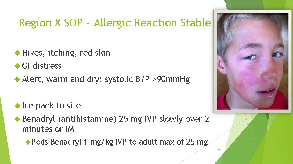 Region X SOP - Allergic Reaction Stable Hives, GI itching, red skin distress Alert,