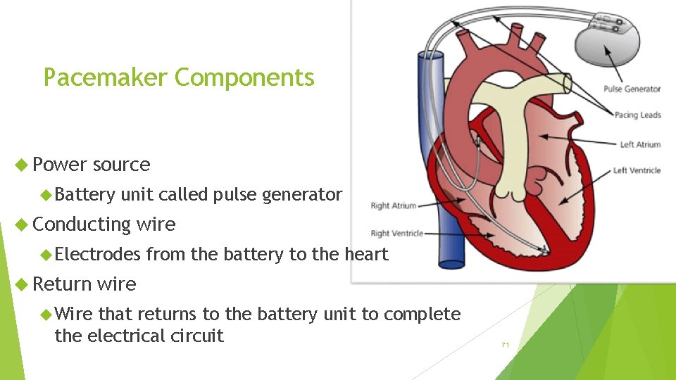 Pacemaker Components Power source Battery unit called pulse generator Conducting wire Electrodes Return from