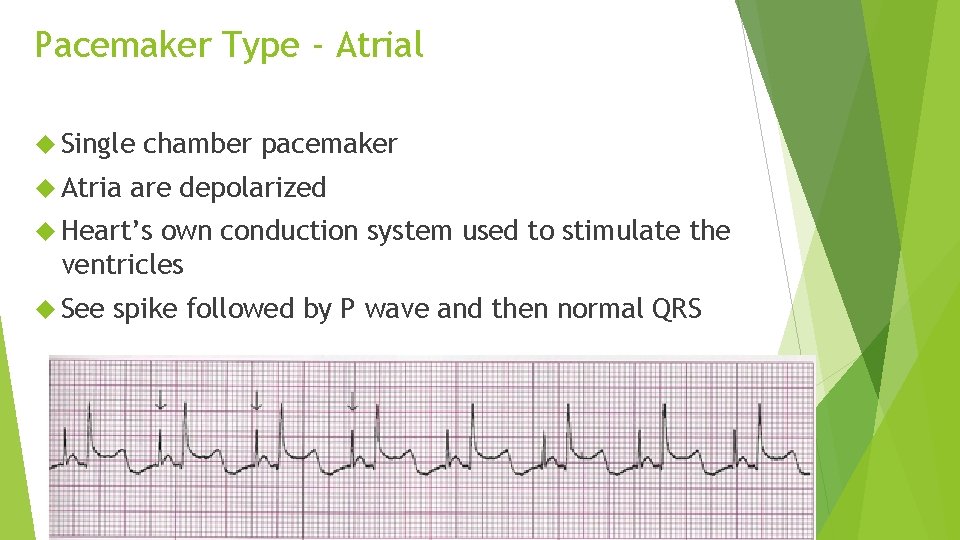 Pacemaker Type - Atrial Single Atria chamber pacemaker are depolarized Heart’s own conduction system