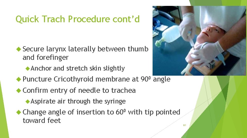 Quick Trach Procedure cont’d Secure larynx laterally between thumb and forefinger Anchor Puncture Confirm