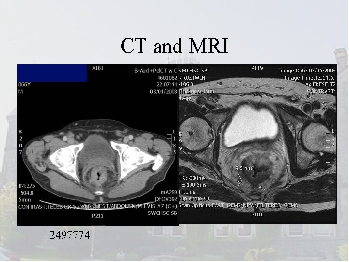CT and MRI 2497774 