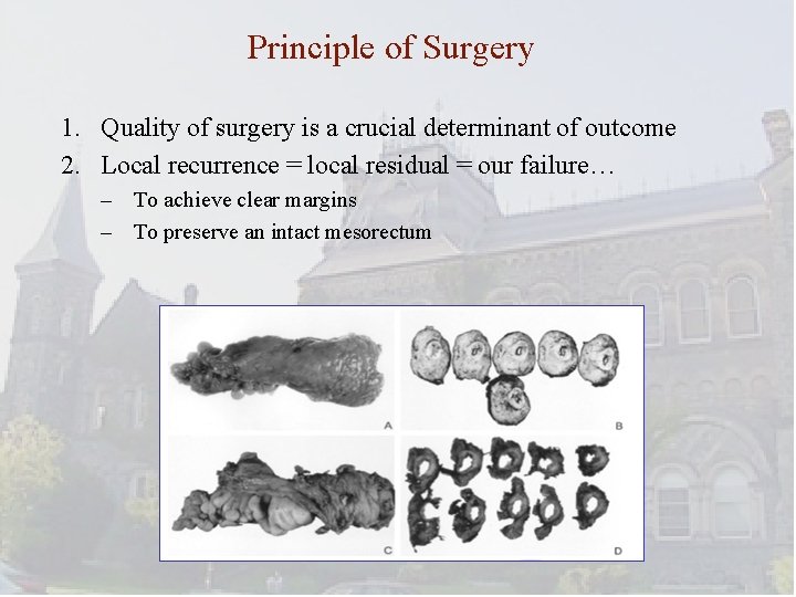 Principle of Surgery 1. Quality of surgery is a crucial determinant of outcome 2.