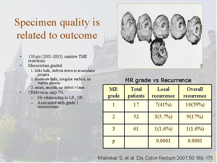 Specimen quality is related to outcome • • 130 pts (2001 -2003) curative TME